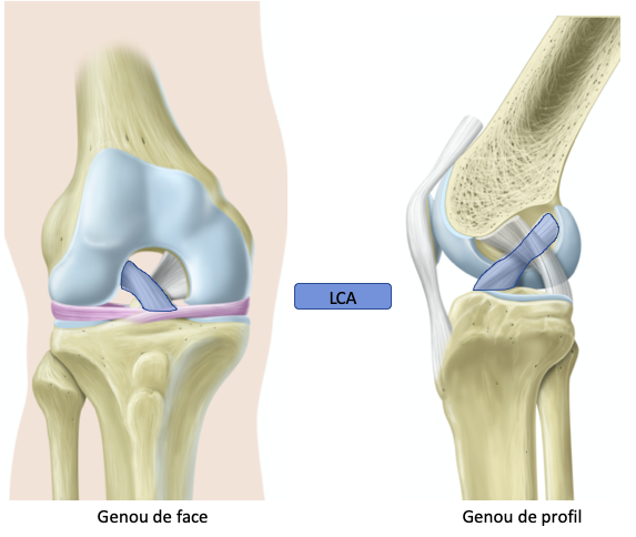 découvrez la durée typique d'hospitalisation après une chirurgie du ligament croisé, ainsi que les étapes de récupération pour un retour rapide à l'activité.