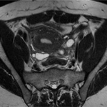 découvrez notre guide complet sur l'irm pelvienne, ses indications, déroulement et avantages pour un diagnostic précis de la région pelvienne.