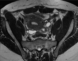 découvrez notre guide complet sur l'irm pelvienne, ses indications, déroulement et avantages pour un diagnostic précis de la région pelvienne.