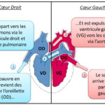 Eau dans les poumons et insuffisance cardiaque : comprendre les liens et les traitements