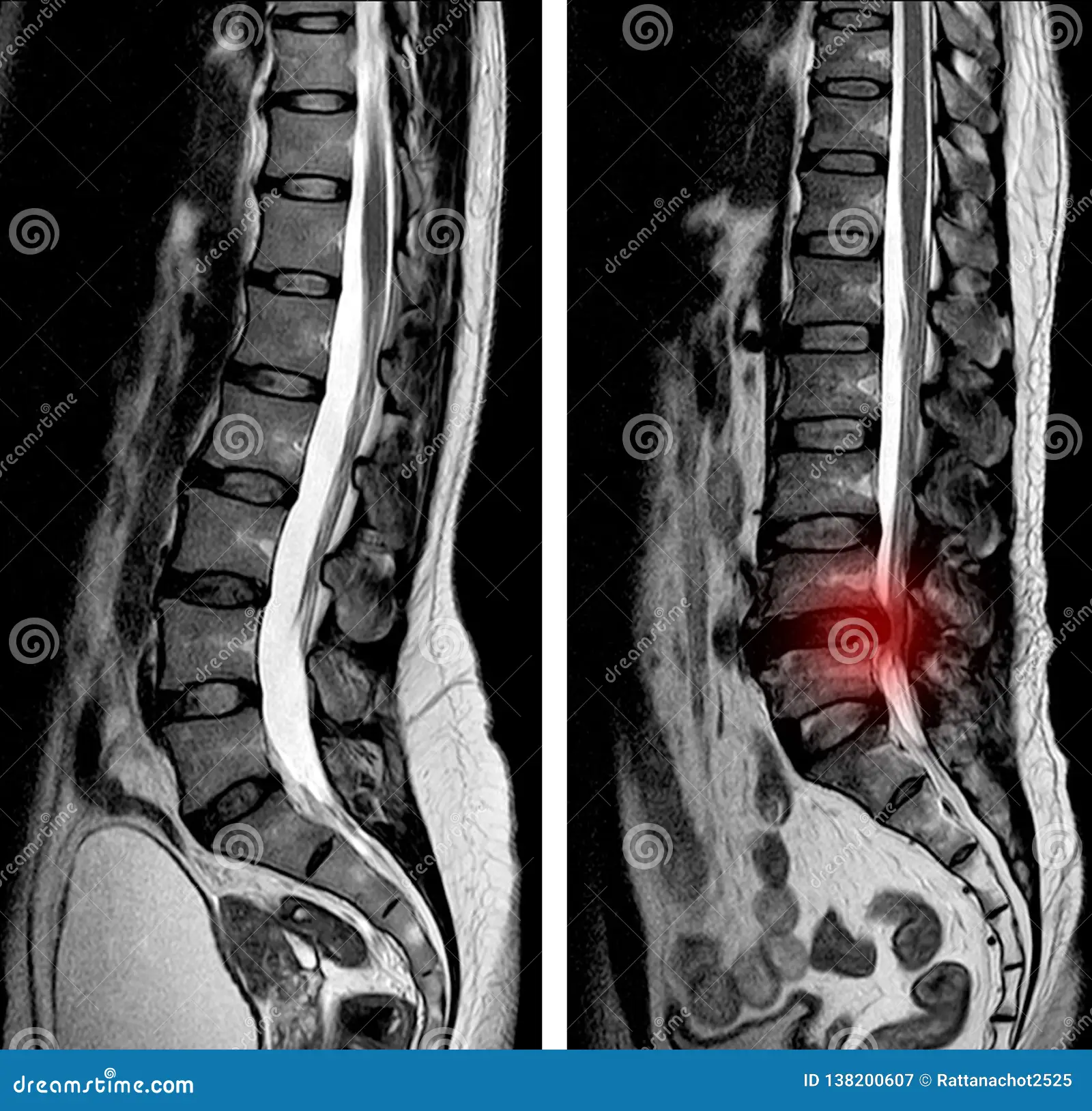 découvrez nos services d'imagerie lombaire pour un diagnostic précis et rapide des pathologies du bas du dos.
