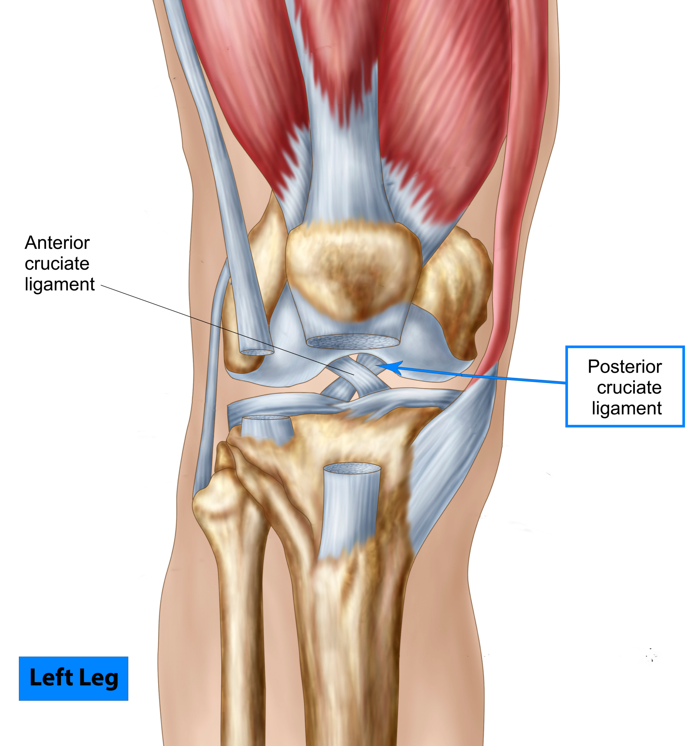 découvrez le temps de guérison du ligament croisé postérieur, les étapes de récupération et les conseils pour un retour optimal à l'activité.