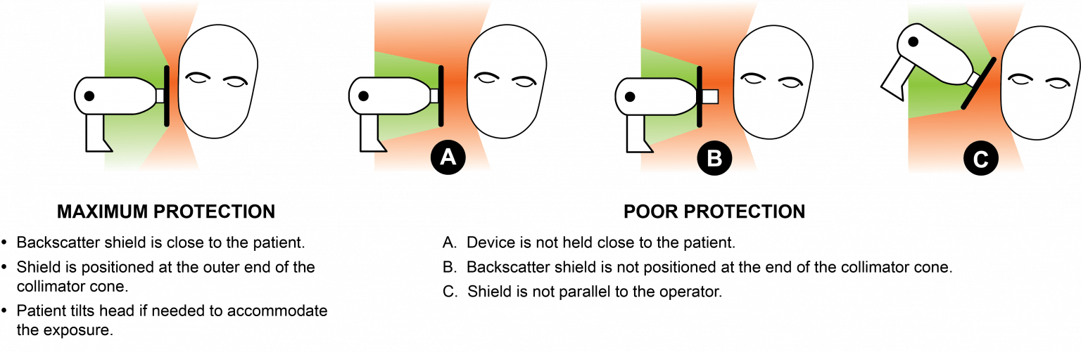 découvrez les meilleures pratiques pour assurer la sécurité lors de l'utilisation des rayons x, protégeant ainsi les patients et le personnel des risques d'exposition.