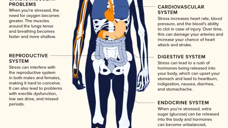 découvrez les effets du stress sur la santé physique et mentale, ainsi que des conseils pour mieux le gérer au quotidien.