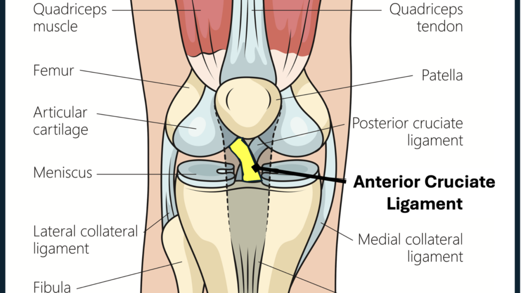 découvrez tout sur le ligament croisé antérieur : anatomie, blessures, symptômes et traitements pour une meilleure compréhension et prise en charge.