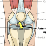 Ligament croisé chez le footballeur : comprendre les blessures et leur prévention