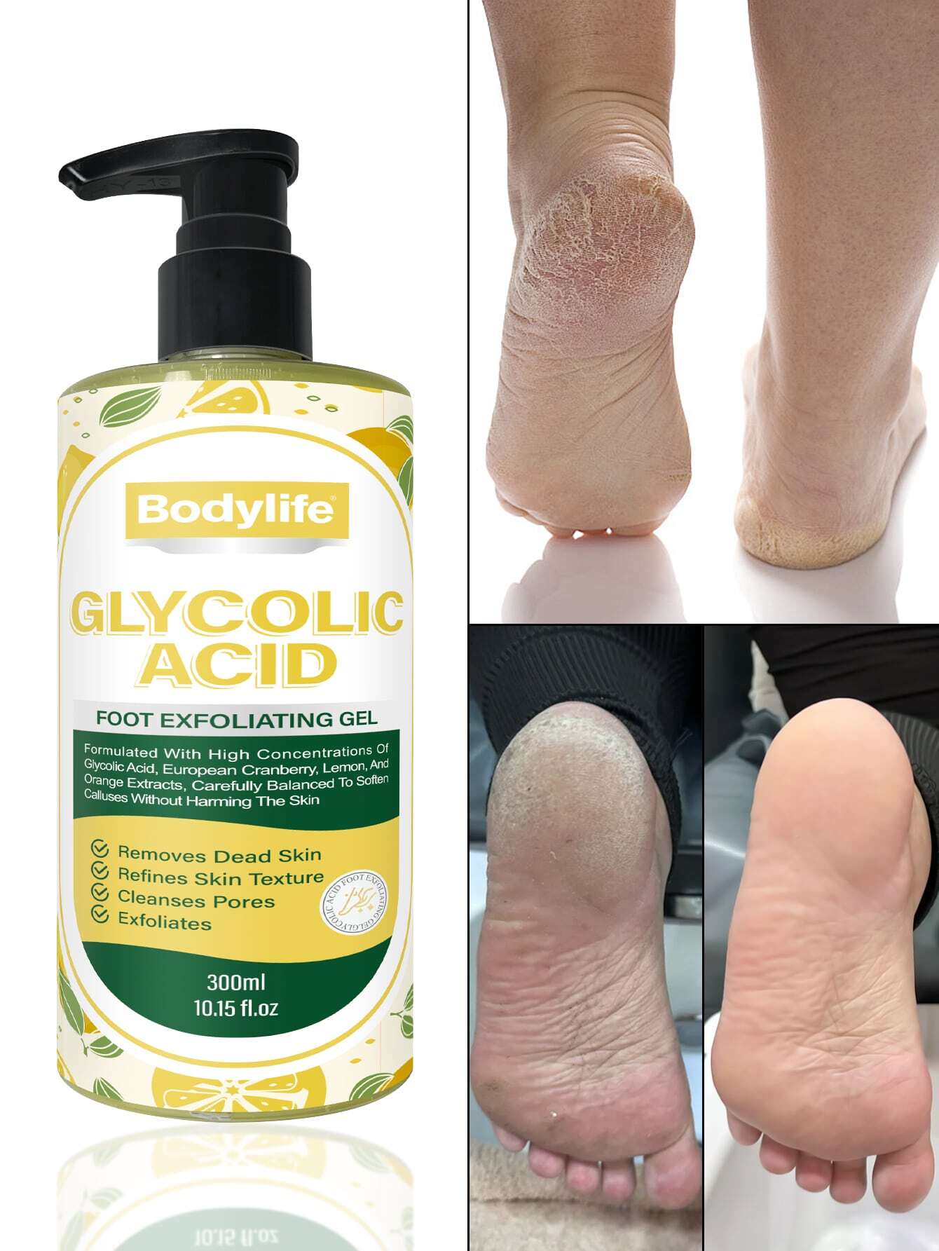 découvrez notre foot gel apaisant pour soulager la fatigue et les douleurs des pieds, offrant fraîcheur et confort tout au long de la journée.