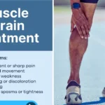 Soigner un claquage musculaire : méthodes efficaces et conseils pratiques