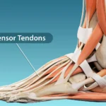 Tendinite sous le pied : remèdes de grand-mère efficaces pour soulager la douleur